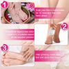 17Pcs Electric Foot Callus Remover with Vacuum Foot Grinder Rechargeable Foot File Dead Skin Pedicure Machine - White
